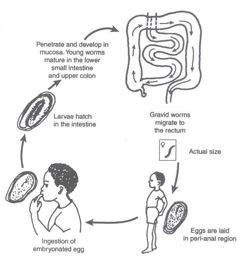 external image Pinworm.jpg